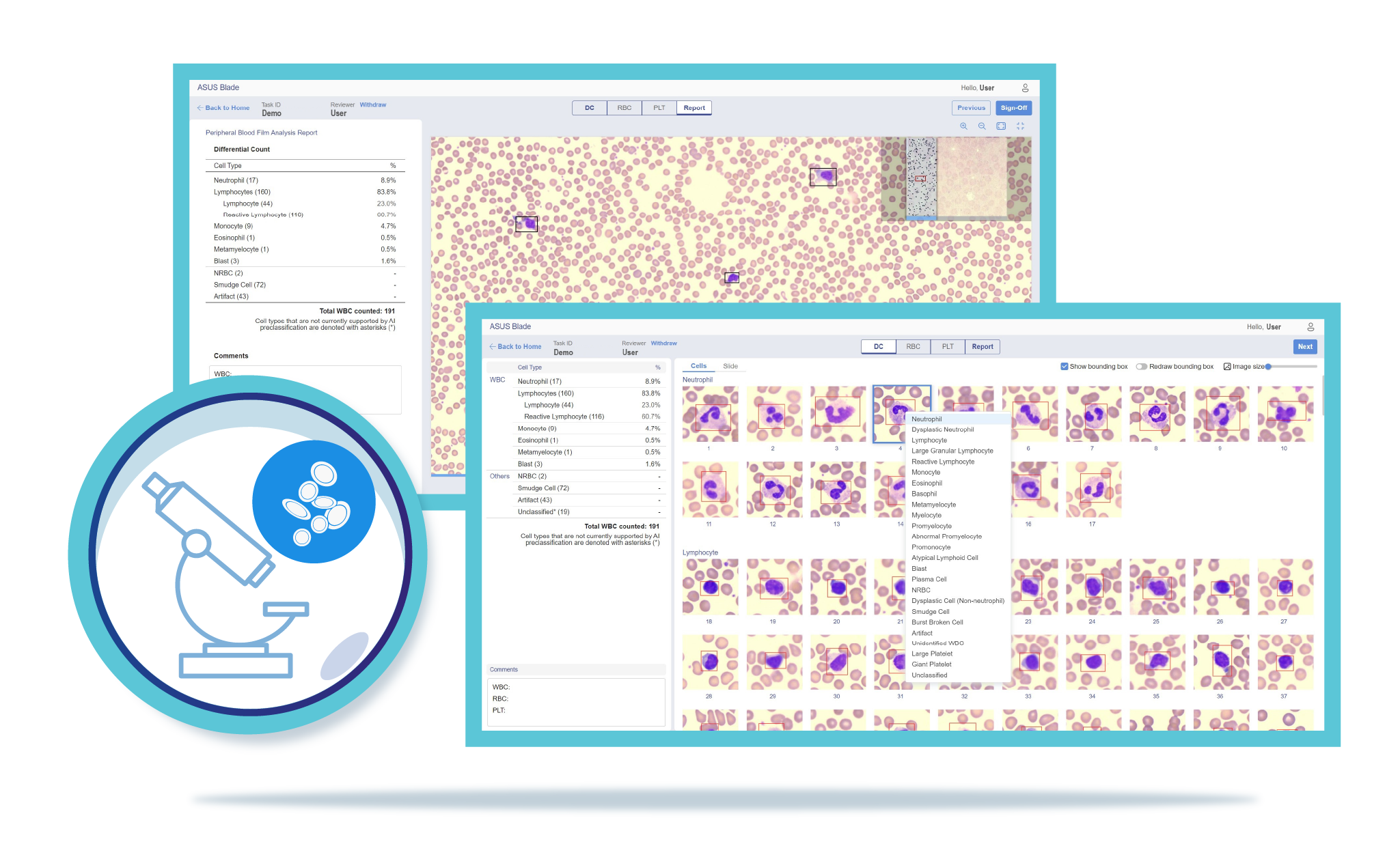 AI Blood Film Analyzer